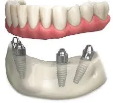 Dental Care