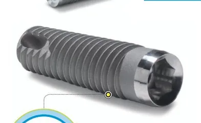 Zimmer Implant