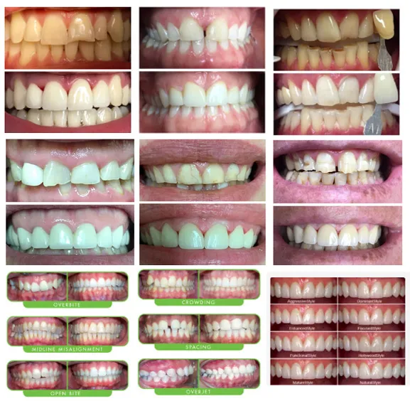 Before and After Dental Treatment